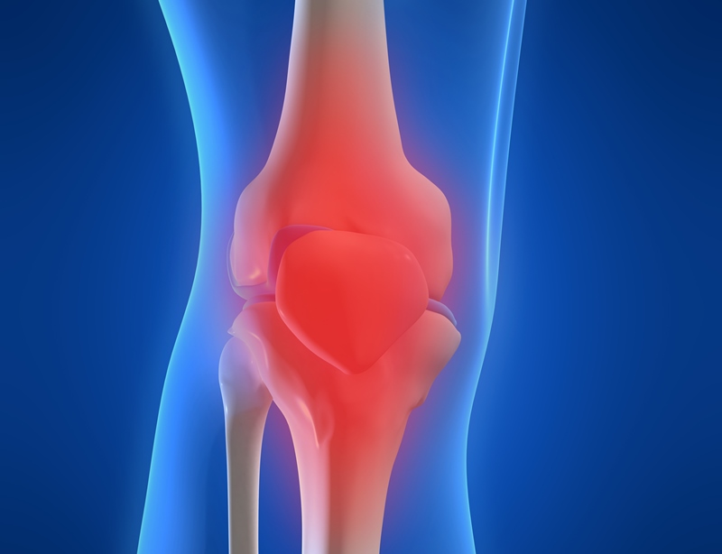 Lesiones del Cartílago Articular Rodilla