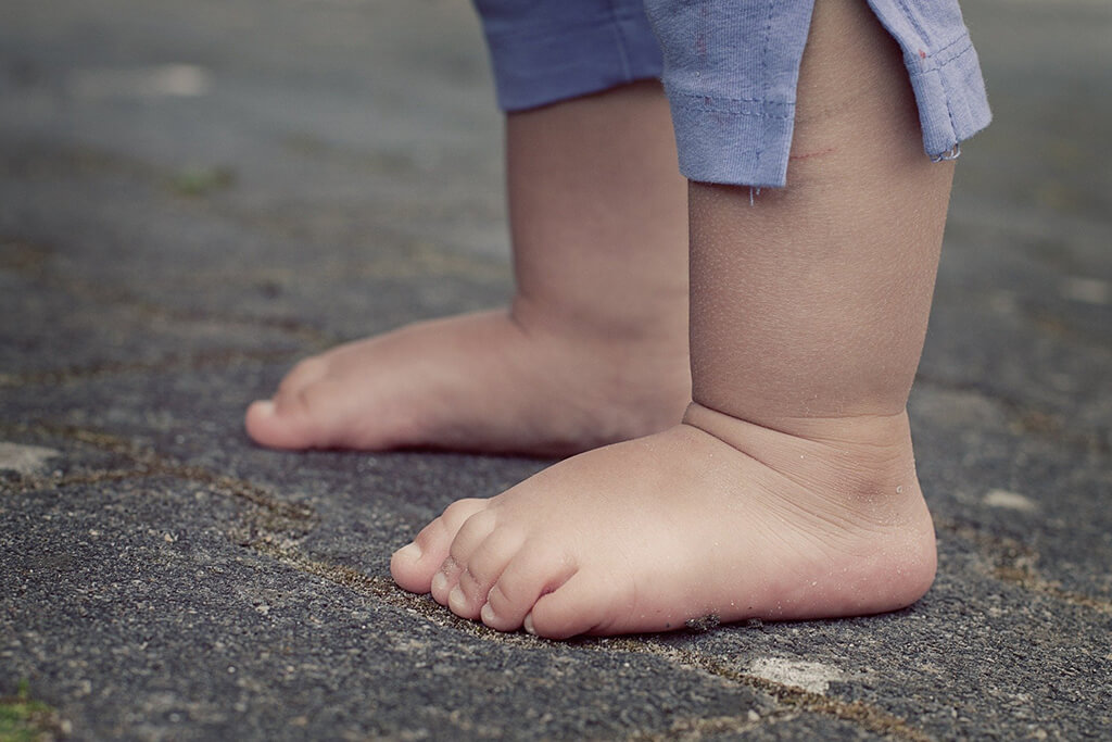Tratamiento para tratar el pie plano en niños