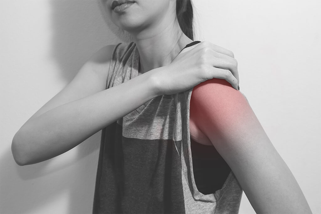 ¿Qué es el síndrome de hombro doloroso?