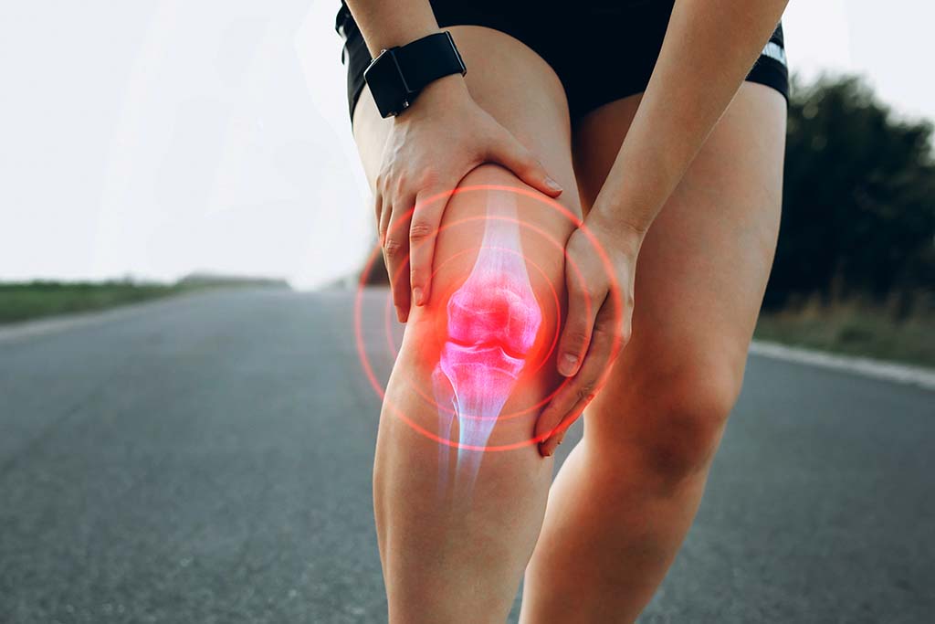 ¿Qué es la osteoartritis de rodilla?