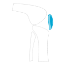 Lesiones y problemas de rodilla